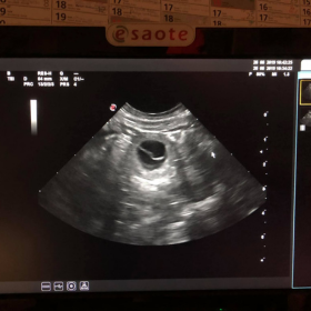 Ultrahang 2019.08.28.